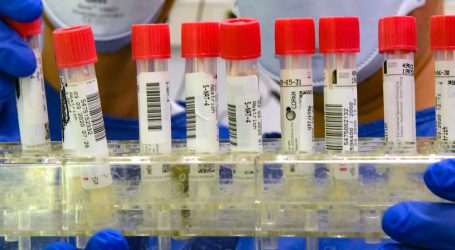 Why Isn’t Coronavirus Testing Increasing in the United States?
